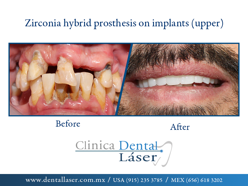 Image Before and after