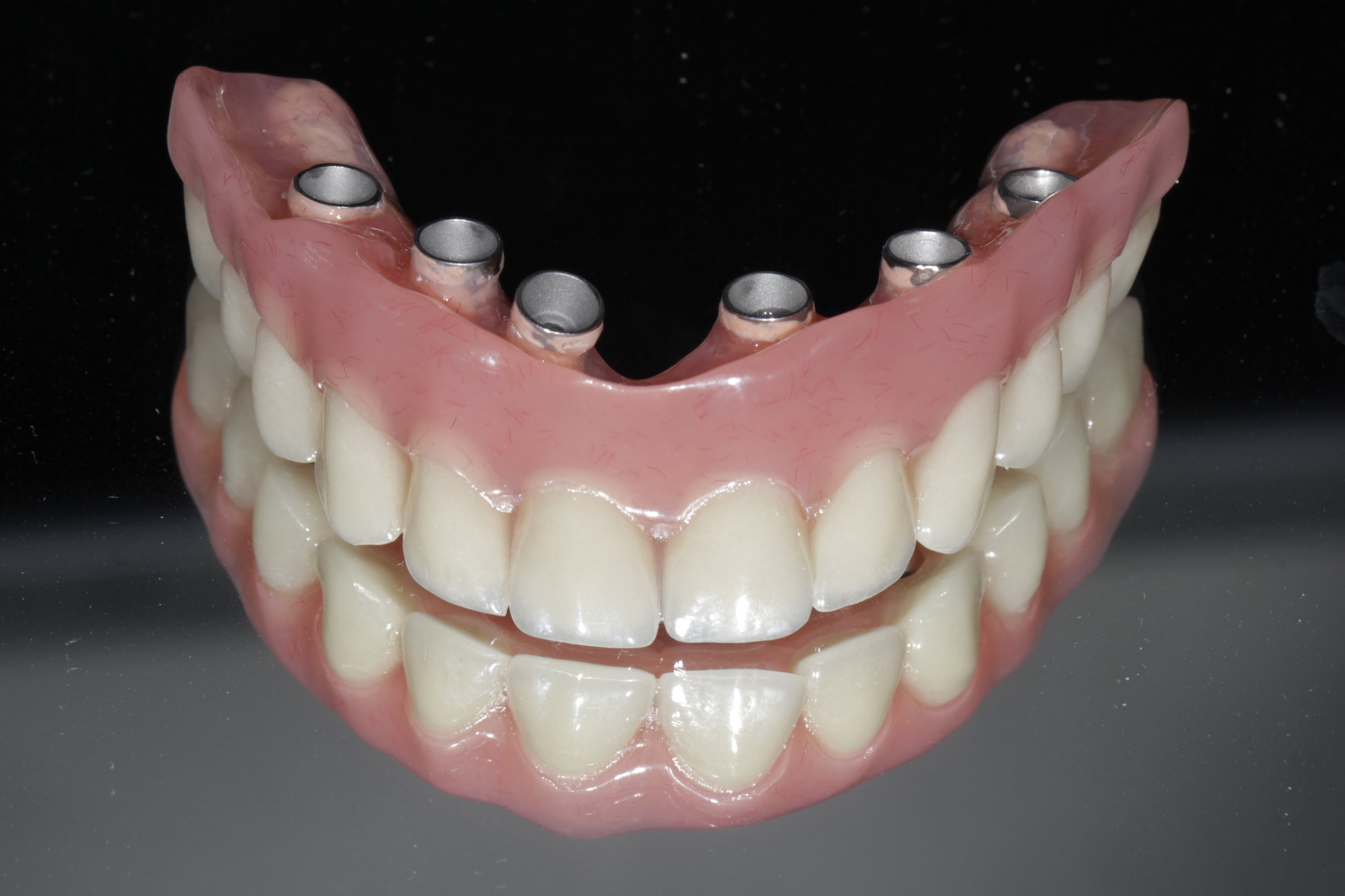 Image Hybrids screwed retained Dentures
