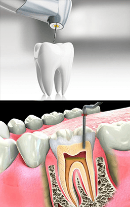 Image endodontics services